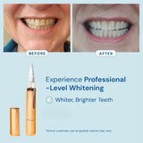 Lumé Whitening Pen