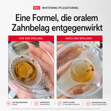 Hismile SnowMint™