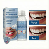 SnapSmile Tooth Repair