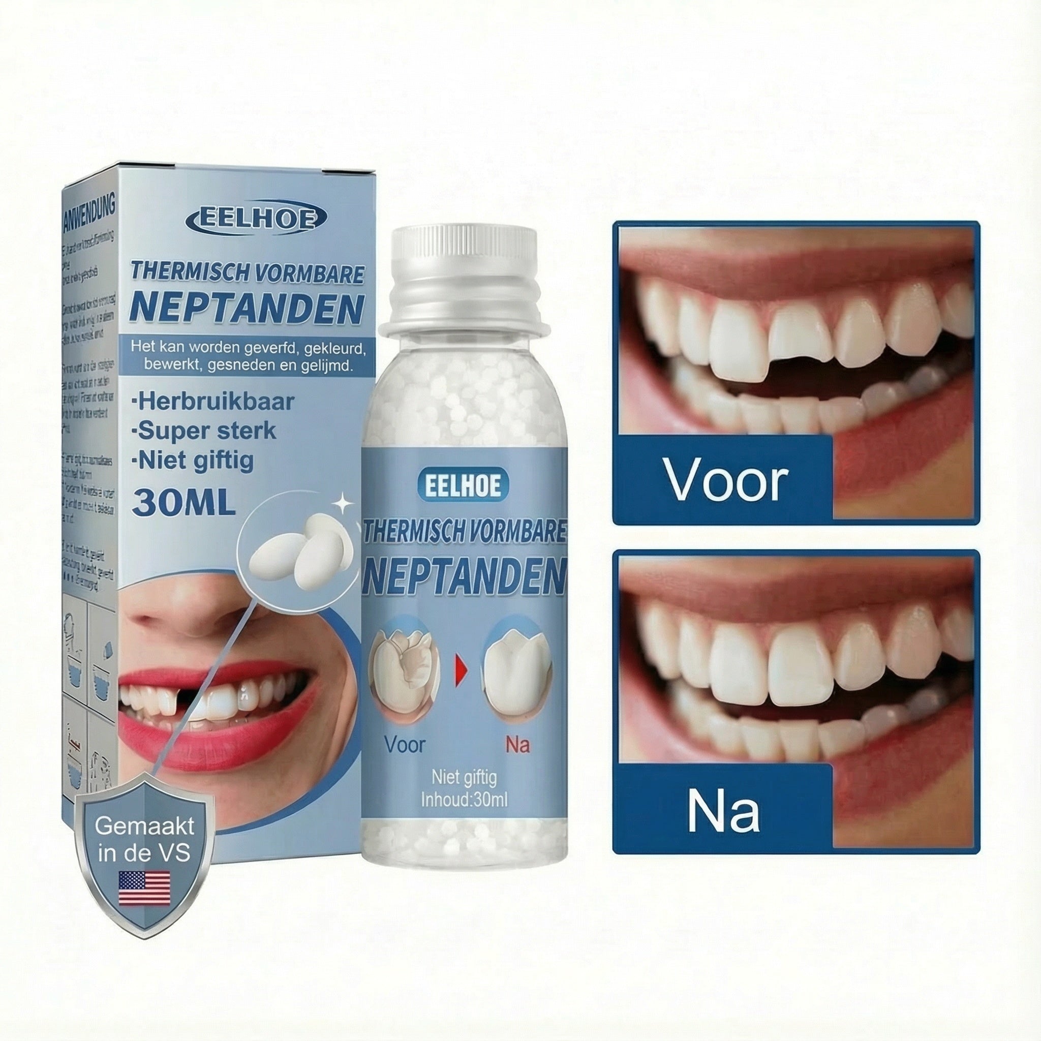 SnapSmile Tooth Repair