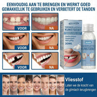 SnapSmile Tooth Repair