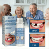 SnapSmile Tooth Repair