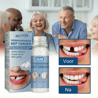 SnapSmile Tooth Repair