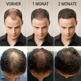 IngwerPulse Wachstumsserum