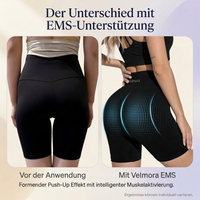 Velmora LiftPro™ EMS Shorts
