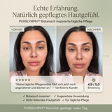 PureLymph™ Body Essence