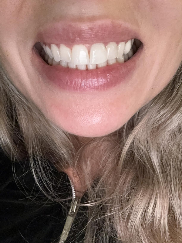 Confidence Starts with a Dazzling Smile 